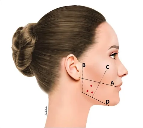 Girne’de Masseter Botoksu